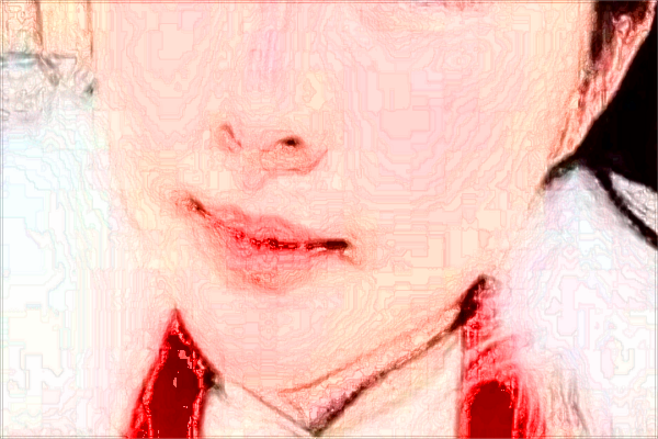 2024大連醫(yī)科大學(xué)附屬第一醫(yī)院祛痣價(jià)目表(價(jià)格表)怎么樣