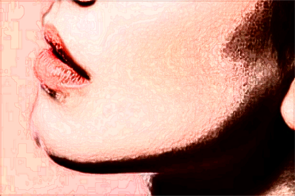 大連醫(yī)科大學(xué)附屬第一醫(yī)院激光去紅血絲做的好嗎_案例價格分享