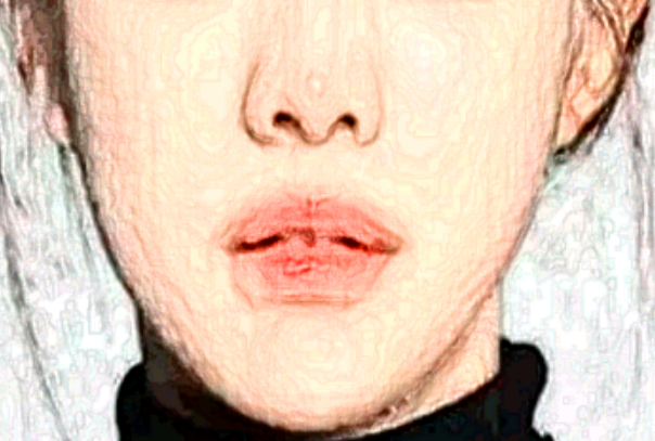 保定市第一中心醫(yī)院激光祛斑價目表(價格表)怎么樣