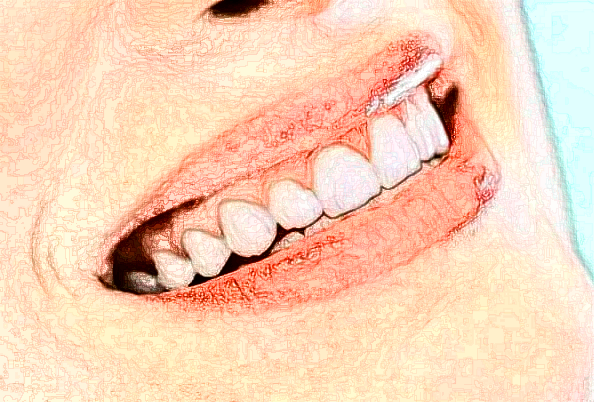 河北醫(yī)科大學(xué)口腔醫(yī)院牙齒貼面價(jià)目表(價(jià)格表)怎么樣