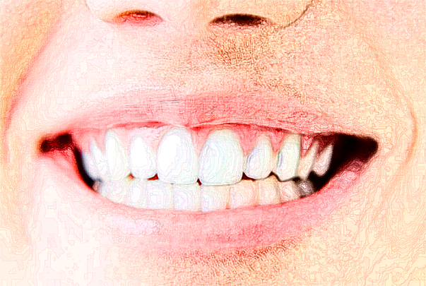 2024河北醫(yī)科大學(xué)口腔醫(yī)院全瓷牙價(jià)目表(價(jià)格表)怎么樣