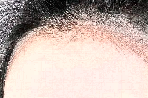 2024常州市第一人民醫(yī)院植發(fā)價(jià)目表(價(jià)格表)怎么樣