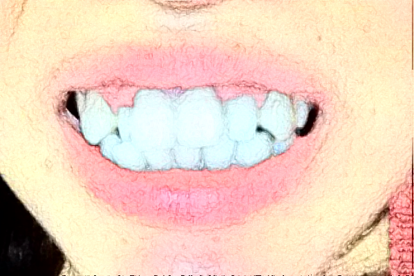 重慶醫(yī)科大學附屬口腔醫(yī)院是三甲醫(yī)院嗎？收費標準