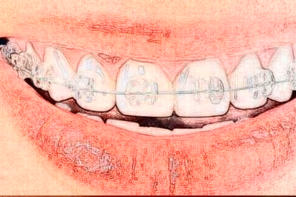 常州市第一人民醫(yī)院口腔科顧敏醫(yī)生技術(shù)怎么樣_擅長什么