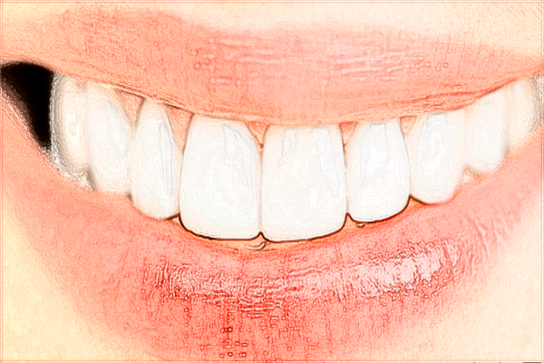 昆明43醫(yī)院牙齒材料有哪幾種?2024牙齒矯正費(fèi)用