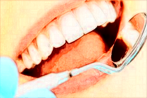 昆明43醫(yī)院牙科怎么樣?2024牙科收費價格?