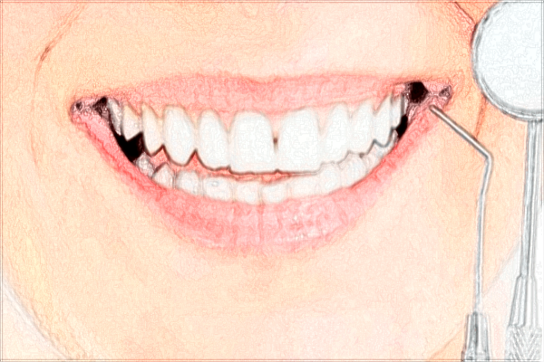 昆明總醫(yī)院口腔科怎么樣?口腔科收費(fèi)價(jià)格2024