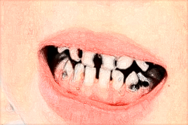 江西省口腔醫(yī)院種植牙哪個醫(yī)生好?2024種植牙醫(yī)生收費(fèi)