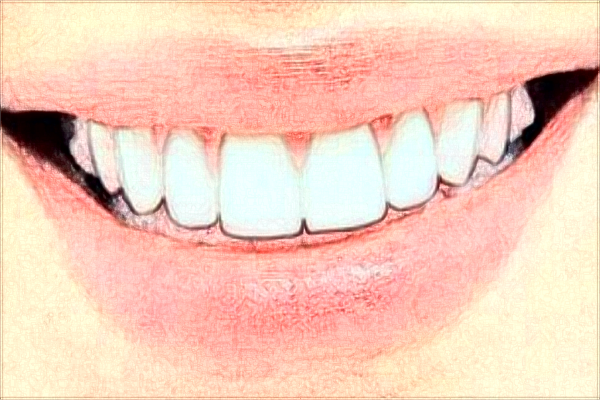 2024四川大學華西口腔醫(yī)院美白牙齒怎么樣_醫(yī)生技術好不好