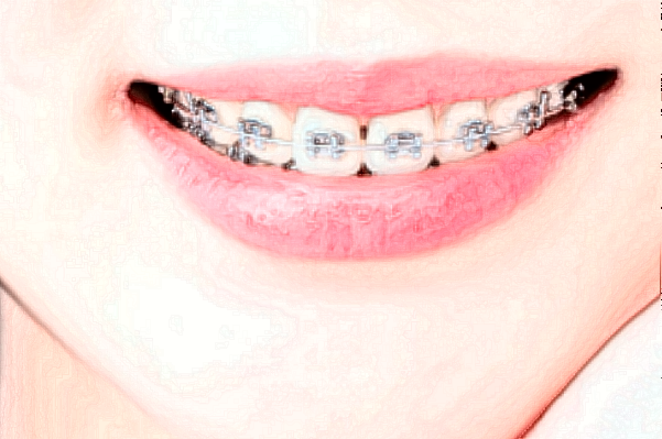 2024常州市第一人民醫(yī)院牙齒矯正價目表(價格表)怎么樣