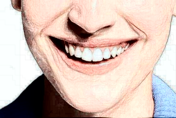 四川大學(xué)華西口腔醫(yī)院牙齒正畸好不好_哪個(gè)醫(yī)生做的不錯(cuò)