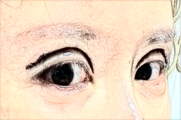 上海切開(kāi)雙眼皮做的好不好_哪家醫(yī)院做的比較好