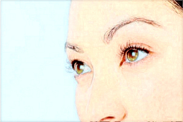 2024金華市中心醫(yī)院激光祛斑做的咋樣_案例分享