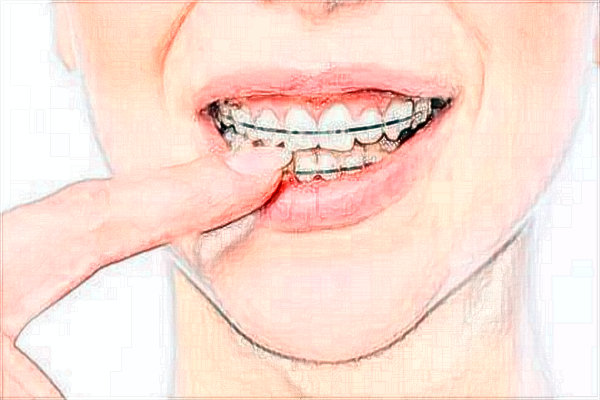 青島401醫(yī)院口腔科怎么樣?口腔科有哪些項(xiàng)目?