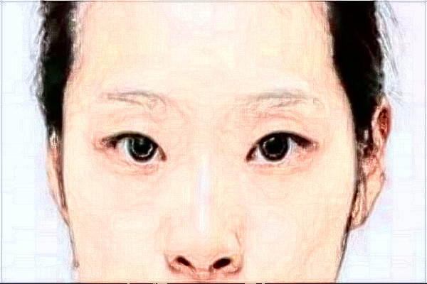 2024臺州醫(yī)院光子嫩膚做的好嗎_誰做的比較好