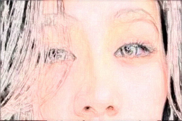 金華市中心醫(yī)院半飛秒做的好嗎_案例+價(jià)格