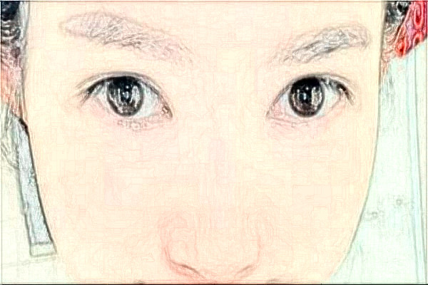 金華市中心醫(yī)院半飛秒做的好嗎_案例+價(jià)格