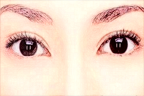 哈爾濱醫(yī)科大學附屬第一醫(yī)院近視手術(shù)做的好嗎_案例+價格