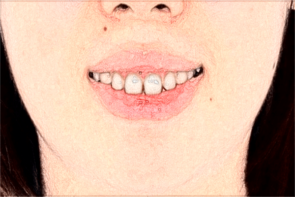 2024南寧市第一人民醫(yī)院牙科貴嗎?牙科收費(fèi)如何?