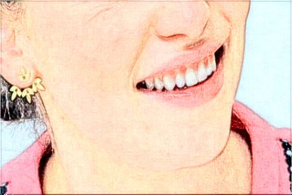 阜陽(yáng)市人民醫(yī)院祛痘做的好不好_醫(yī)生技術(shù)怎么樣