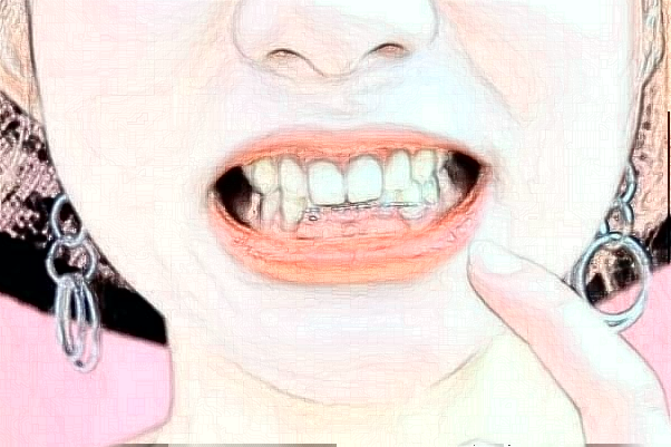 2024阜陽市人民醫(yī)院牙齒矯正做的好嗎_誰做的比較好