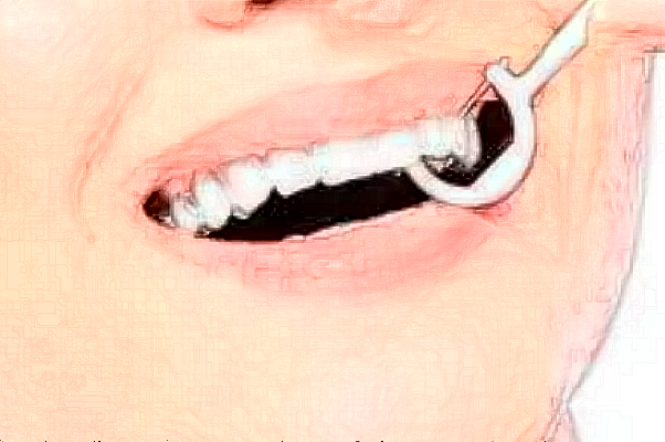 2024徐州市中心醫(yī)院種植牙做的好嗎_誰做的比較好