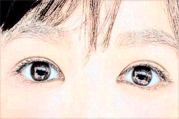 2024阜陽市人民醫(yī)院近視激光手術(shù)做的好嗎_誰做的比較好