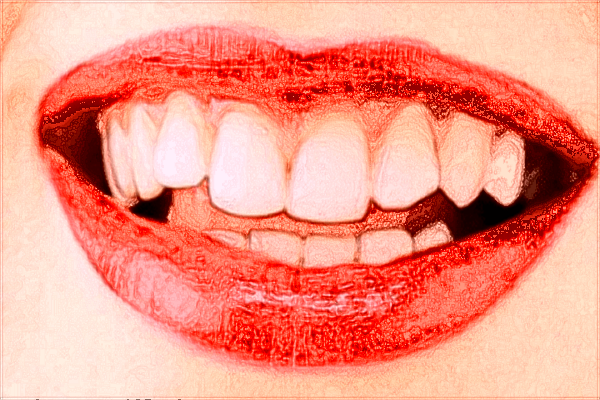 2024中山大學附屬第一醫(yī)院矯正牙齒多少錢?矯正牙齒怎么樣