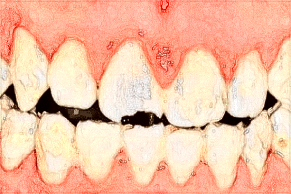 中山大學(xué)附屬第一醫(yī)院牙科好嗎?2024牙科收費(fèi)如何