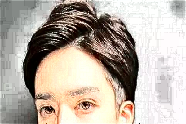 中山大學(xué)附屬第一醫(yī)院植發(fā)掛什么科?植發(fā)后注意事項(xiàng)