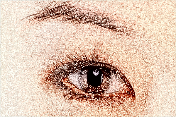 2024珠海市人民醫(yī)院去眼袋手術(shù)大概價格?去眼袋多久恢復(fù)正常