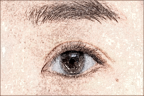 2024珠海市人民醫(yī)院去眼袋手術(shù)大概價格?去眼袋多久恢復(fù)正常