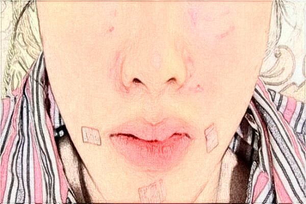 2024阜陽市人民醫(yī)院整形美容外科怎么樣？2024醫(yī)生介紹