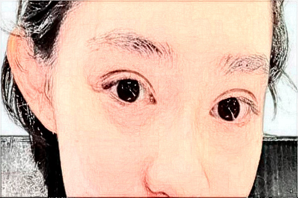 2024臺州醫(yī)院飛秒做的好嗎_誰做的比較好