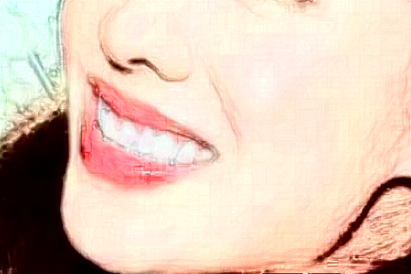 臺(tái)州醫(yī)院口腔科正頜價(jià)目表(價(jià)格表)怎么樣