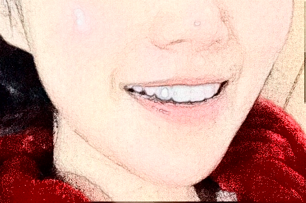 天津市第一中心醫(yī)院種植牙怎么樣_哪位醫(yī)生技術(shù)比較不錯(cuò)