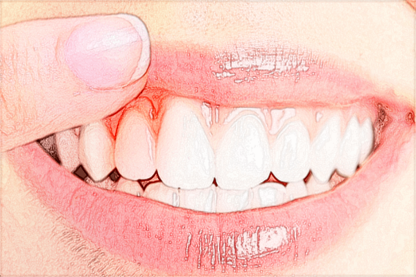 2024廣東省中醫(yī)院珠海醫(yī)院比較好的牙科專家?收費(fèi)貴嗎?