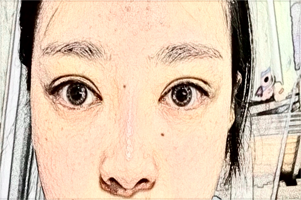 2024天津人民醫(yī)院激光祛斑怎么樣？案例價格一覽