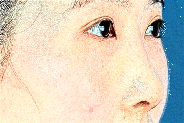 2024天津人民醫(yī)院激光祛斑怎么樣？案例價格一覽