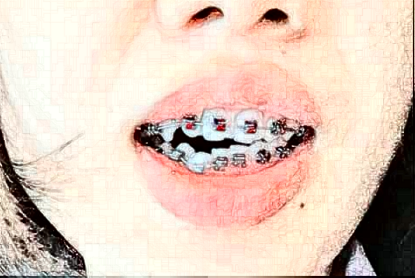 蘇州牙科醫(yī)院排行榜前五強(qiáng)揭曉!2024哪家技術(shù)好？