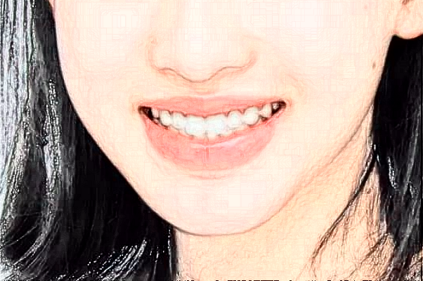 天津市口腔醫(yī)院瓷貼面價(jià)目表(價(jià)格表)怎么樣