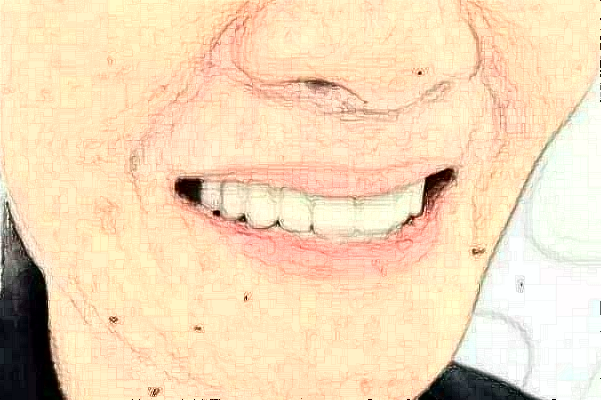 徐州市中心醫(yī)院口腔科張靜醫(yī)生技術(shù)好不好_擅長哪些項(xiàng)目