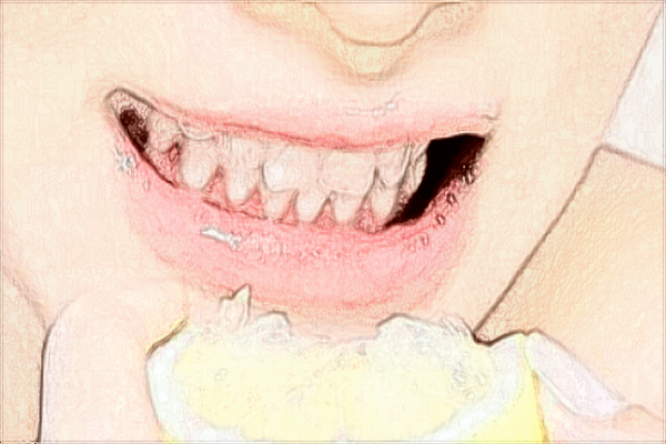 珠海市人民醫(yī)院口腔科哪個醫(yī)生好?2024收費價格貴嗎