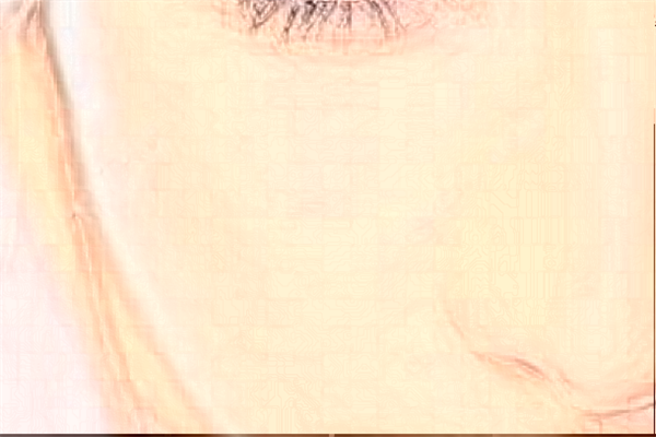 2024泉州180醫(yī)院祛疤怎么樣?激光祛疤價格多少?