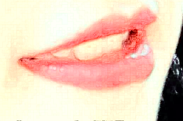 2024天津市口腔醫(yī)院牙齒修復(fù)怎么樣_醫(yī)生排名_案例