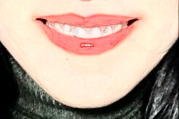 2024天津市口腔醫(yī)院全麻補(bǔ)牙價(jià)目表(價(jià)格表)怎么樣