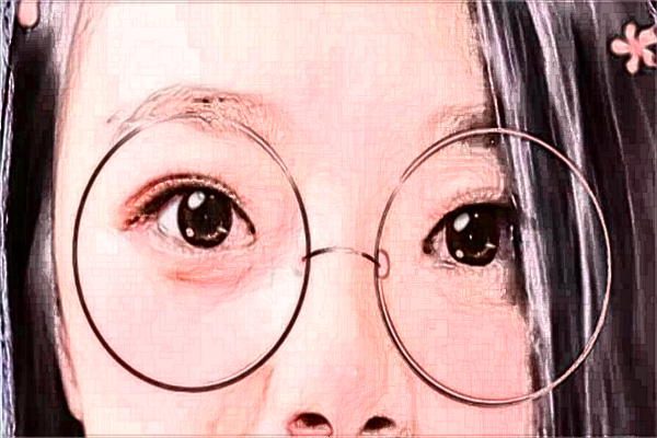 阜陽市人民醫(yī)院近視激光手術(shù)需要多少錢【案例分享】