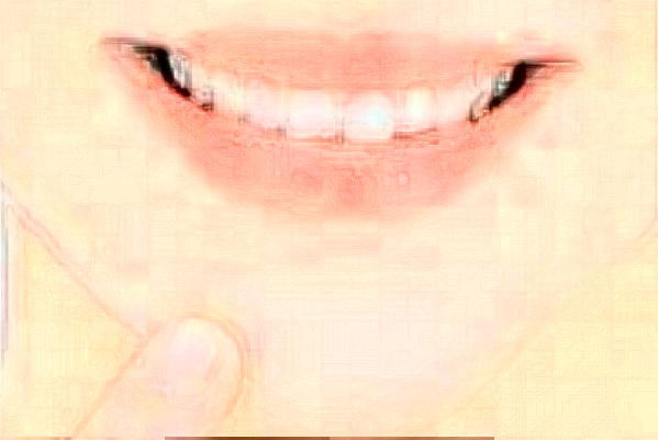 天津醫(yī)科大學(xué)口腔醫(yī)院正畸怎么樣_醫(yī)生排名_案例