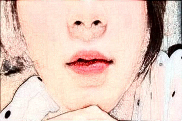 天津市第一中心醫(yī)院祛斑多少錢?祛斑日記分享