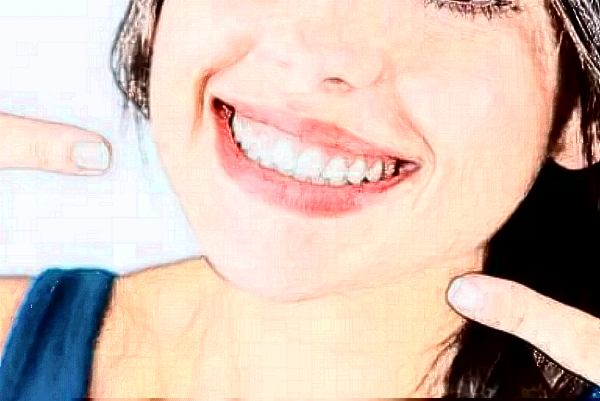 2024哈爾濱242醫(yī)院口腔科烤瓷冠做的好嗎？哪位醫(yī)生做的好